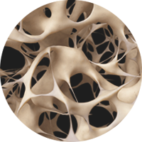 Osteoporose